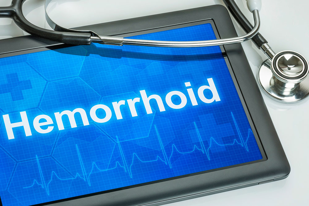Signs and Symptoms of Hemorrhoids